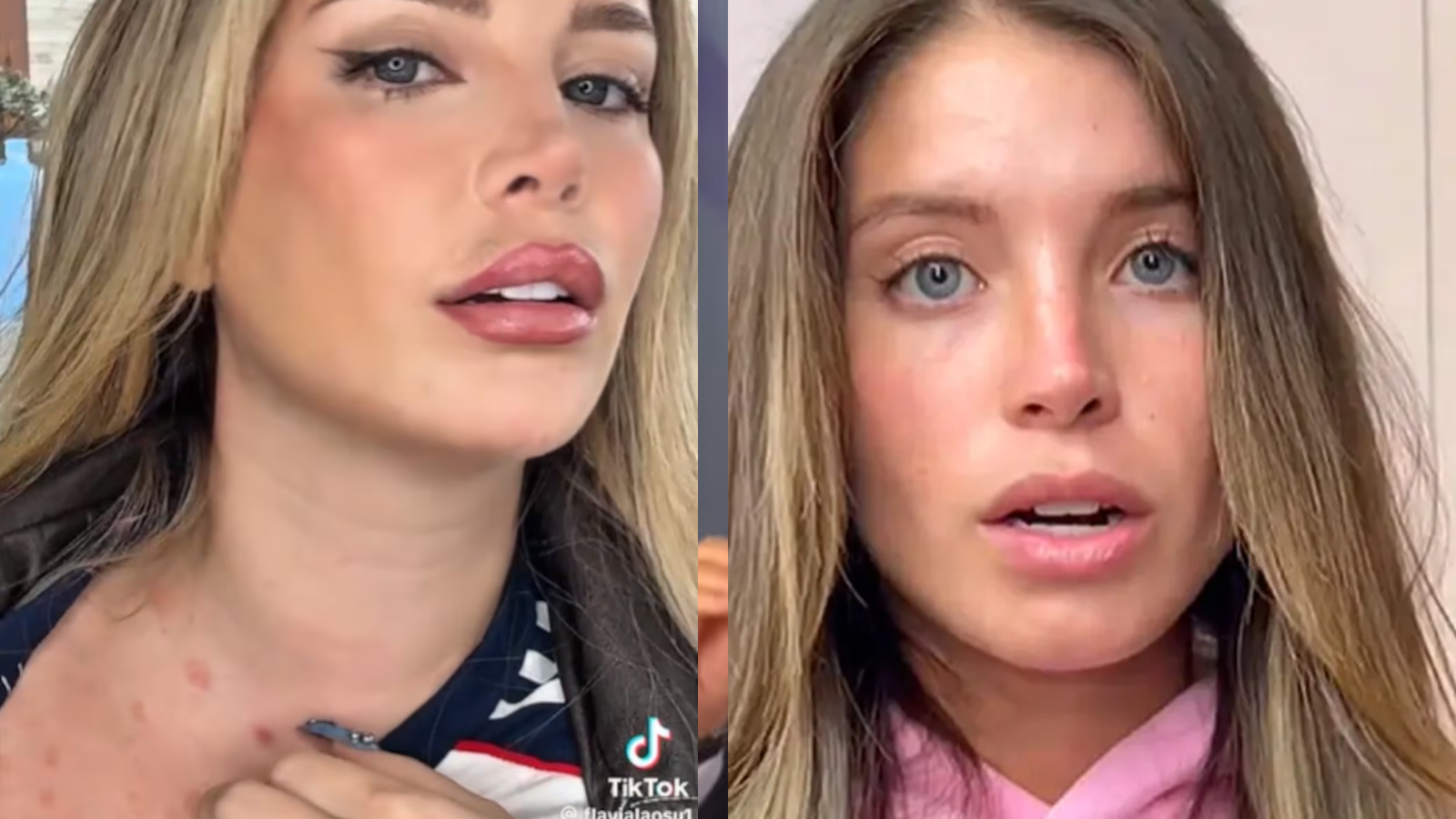 Flavia Laos revela que padece enfermedad incurable y enfrenta este difícil momento: “No lo veo como un castigo”