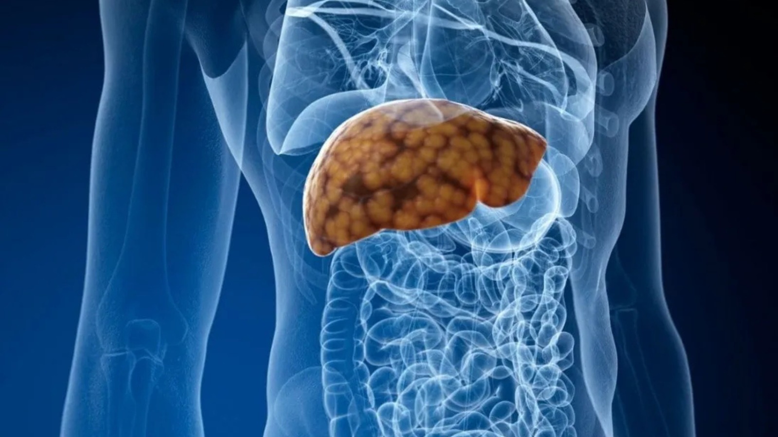 Los mejores hábitos para prevenirlo –