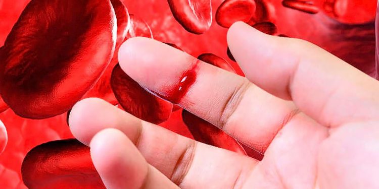 ¿Cuántos casos hay en Perú? –