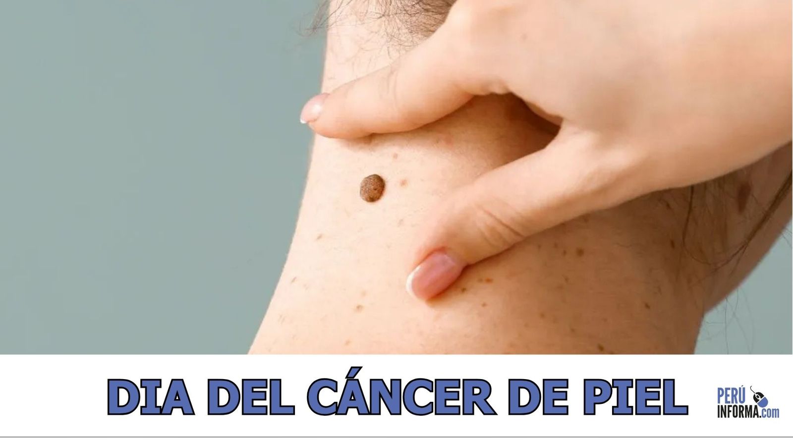 protegerse del sol es salvar vidas –