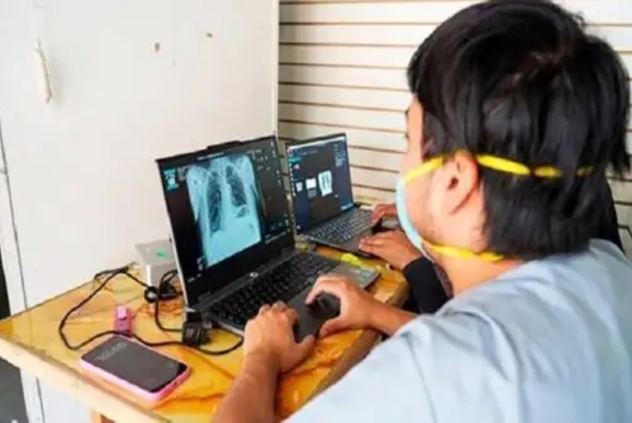 San Martín fortalece la detección oportuna de la tuberculosis con tecnología de vanguardia –